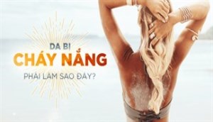 Sau khi đi nắng về hãy thực hiện việc này để làm dịu da nhanh chóng