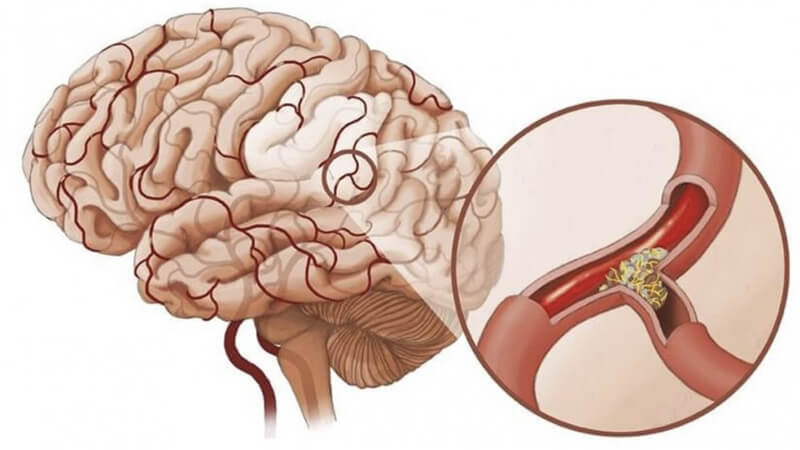 Xem điện thoại khi đi vệ sinh: Tưởng chừng vô hại nhưng nguy hiểm không ngờ