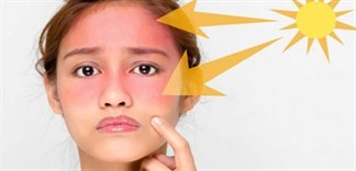 Cách phòng tránh tác hại của tia UV khi ra đường trong thời tiết nắng nóng