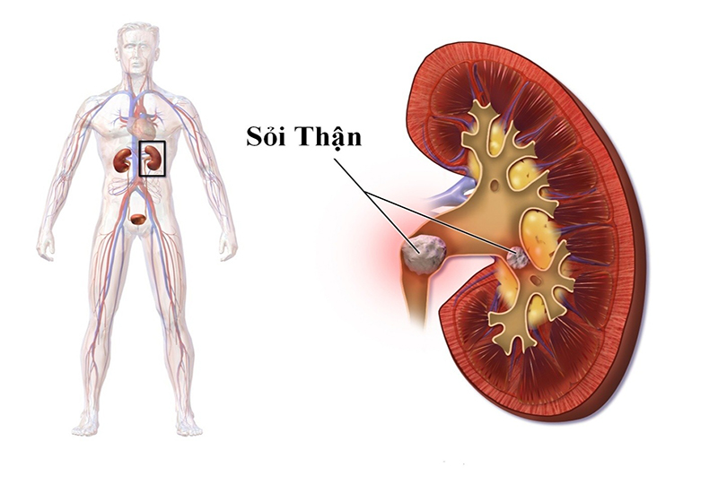 Cây chó đẻ - Thần dược cho gan mật