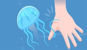 Cách xử lý khi bị sứa cắn, thích tắm biển phải biết điều này