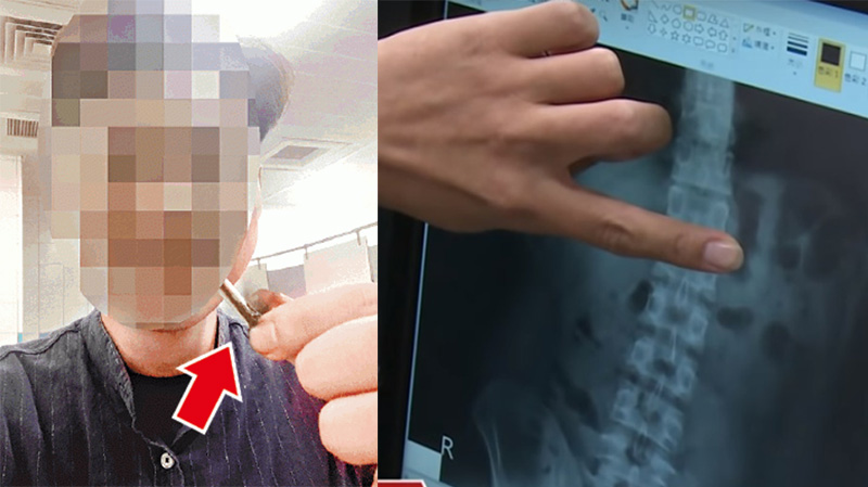 Ảnh chụp X-quang