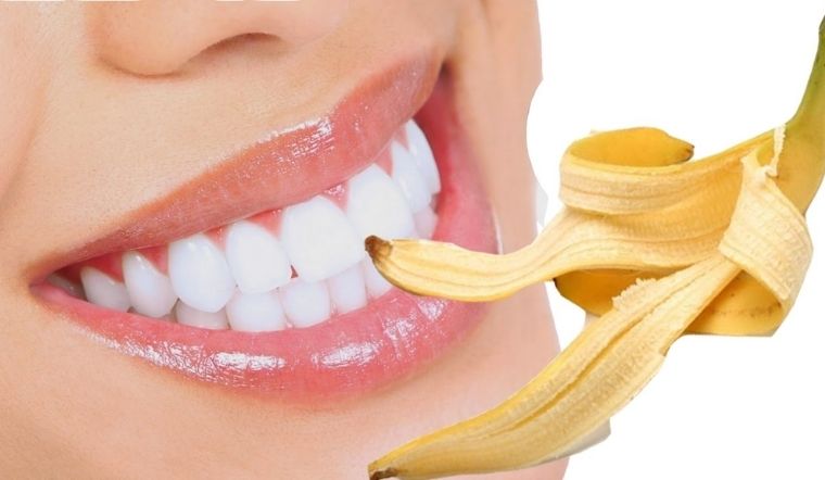 Răng trắng bật tông sau vài lần sử dụng vỏ chuối