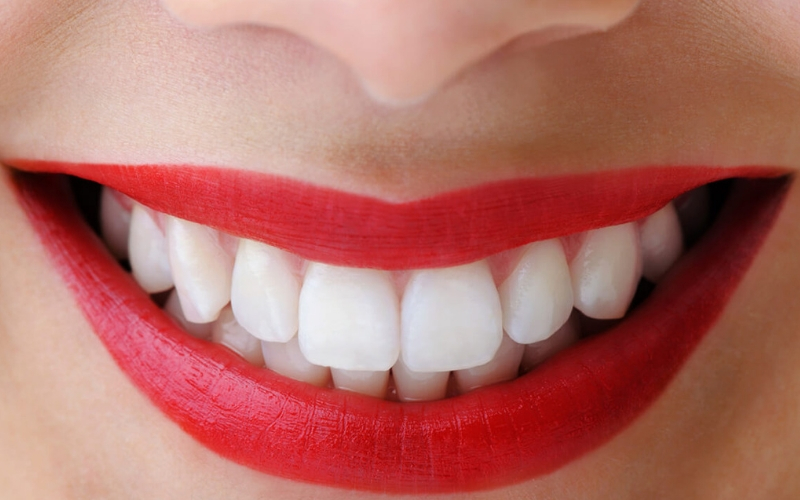 Không sợ răng ố vàng chỉ với 7 loại kem đánh răng dưới đây Không sợ răng ố vàng chỉ với 7 loại kem đánh răng dưới đây