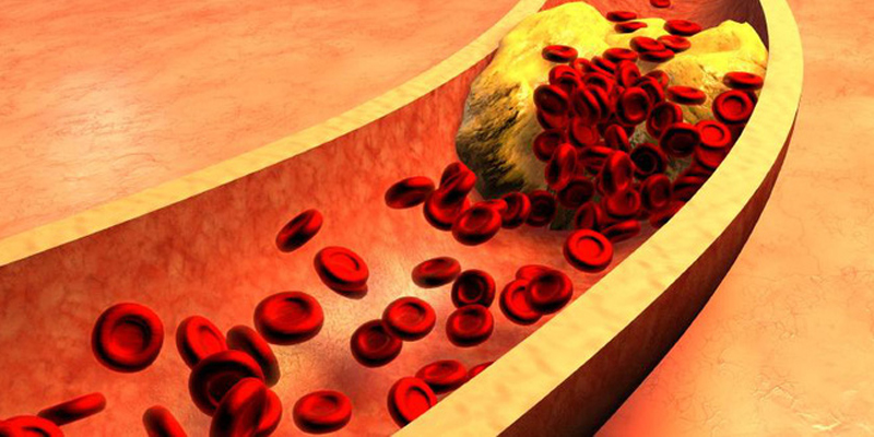 Nấm rơm - thực phẩm giá rẻ nhưng muôn vàn lợi ích Nấm rơm giảm cholesterol