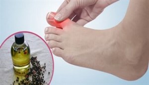 Phát hiện khả năng chống bệnh gout của tinh dầu hạt tiêu