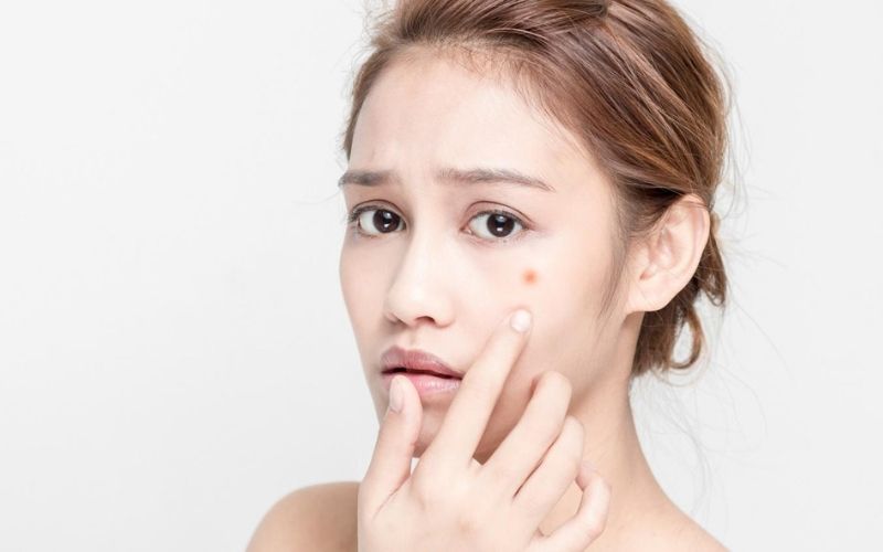Applying these methods, acne automatically disappears