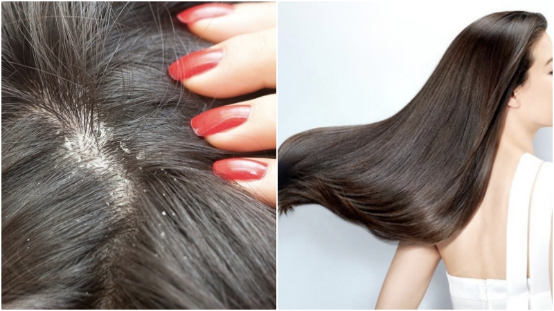 Vỏ bưởi giúp dưỡng tóc, trị gàu và trị rụng tóc, hói đầu