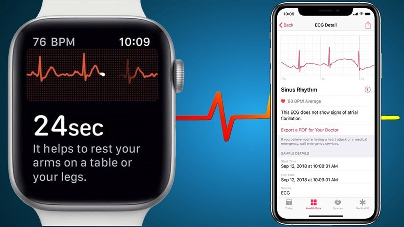 Apple Watch Apple Watch