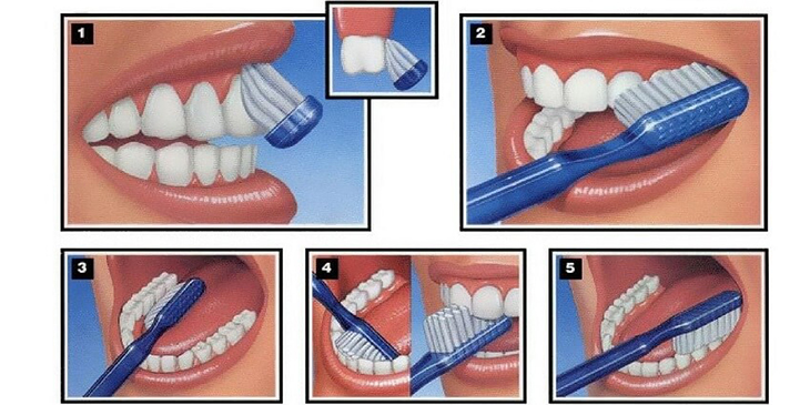 Kỹ thuật đánh răng đúng cách