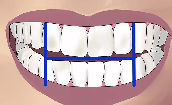 Chia miệng của bạn thành bốn góc