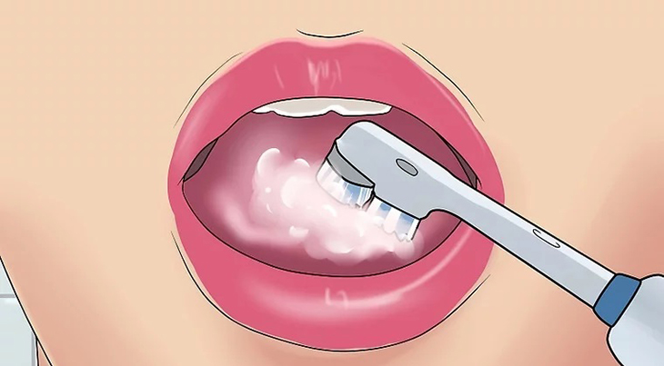 Làm sạch bề mặt lưỡi và vòm miệng