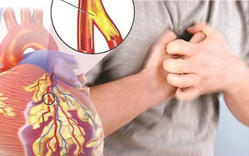 Người giắt dịch tương quan cho tới tăng áp và bệnh về tim mạch tránh việc ăn pate nhiều
