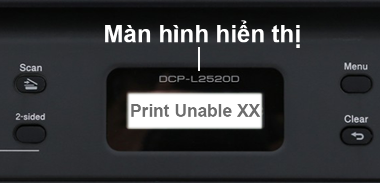 Màn hình báo lỗi Print Unable XX