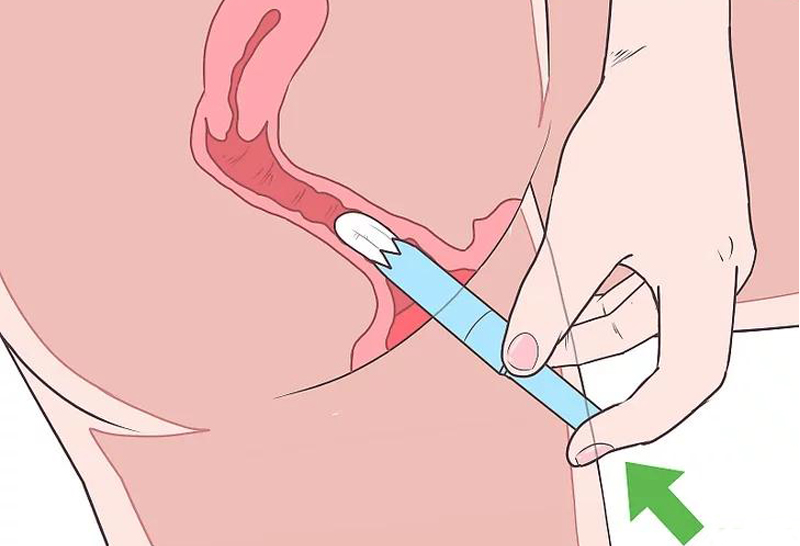 Hướng dẫn sử dụng tampon đúng cách và an toàn trong ngày đèn đỏ