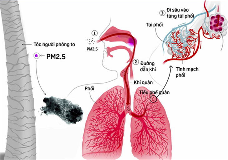 Bụi mịn PM2.5 là gì? Tác hại và cách phòng tránh bụi mịn PM2.5