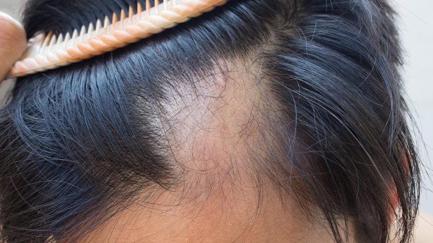 Những nguy hại khi sử dụng sáp vuốt tóc kém chất lượng