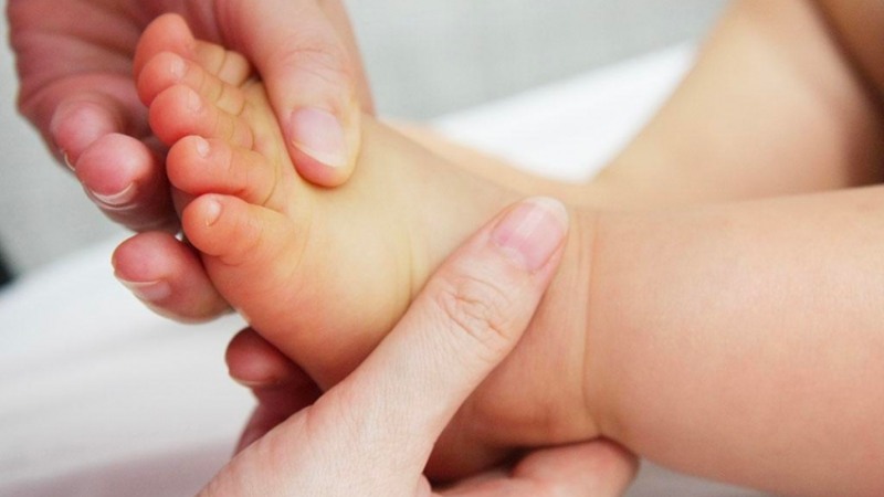 Nếu một đứa trẻ bị vàng da trong 24 giờ đầu tiên sau khi sinh thì nó luôn được coi là nghiêm trọng