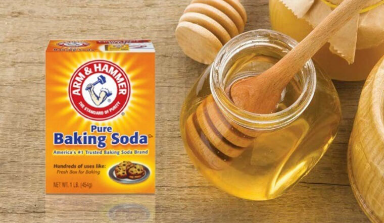 Gàu không còn là nổi lo với công thức trị gàu tận gốc bằng baking soda