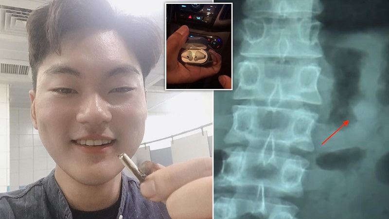 AirPods vẫn hoạt động tốt và còn 41% pin sau khi 'phiêu lưu' qua hệ thống tiêu hóa của một người đàn ông AirPods vẫn hoạt động tốt và còn 41% pin sau khi 'phiêu lưu' qua hệ thống tiêu hóa của một người đàn ông