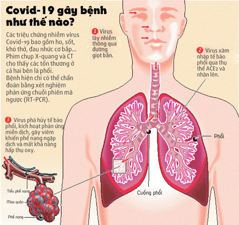 Virus Covid-19 tàn phá cơ thể người bằng cách nào?