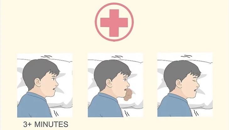 Seek medical attention immediately if seizure symptoms persist for more than 3 minutes.