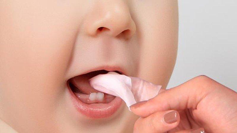 Cách xử lý khi bị tưa lưỡi