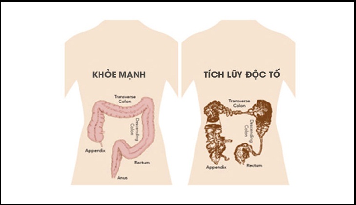 Đào thải độc tố