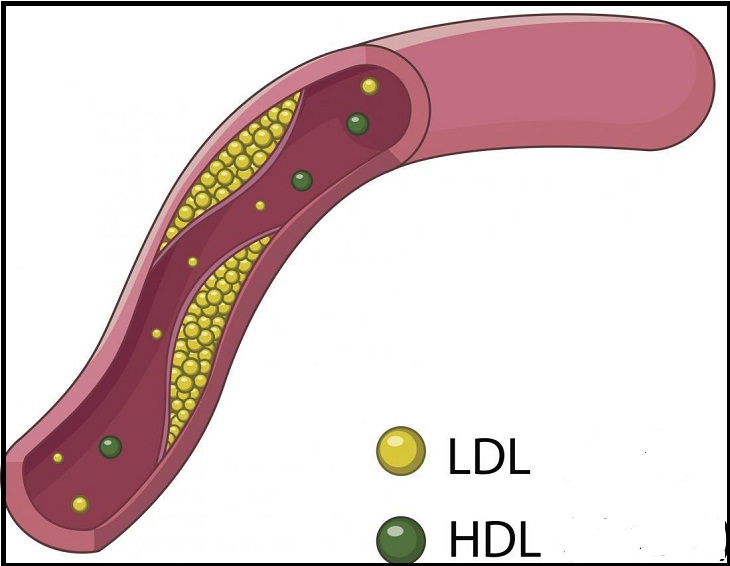 Phân biệt cholesterol xấu và tốt