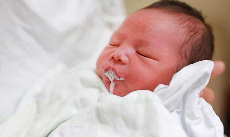 5 mẹo dân gian trị ọc sữa cho trẻ sơ sinh hiệu quả mà an toàn