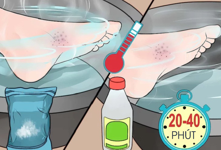 Ng&acirc;m vết thương.