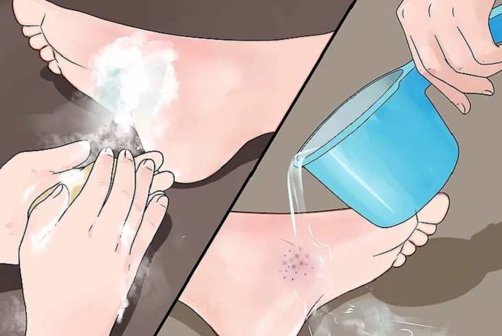 Rửa bằng dung dịch s&aacute;t khuẩn v&agrave; nước.