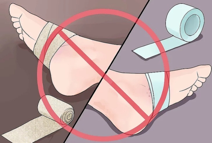 Kh&ocirc;ng băng b&oacute; vết thương.