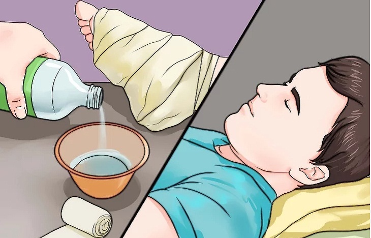 Xử l&yacute; vết thương trước khi đi ngủ.