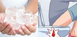 Những mẹo làm giảm chảy máu khi mắc bệnh trĩ