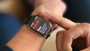 Tính năng xác định lượng calories tiêu thụ trên smartwatch là gì?