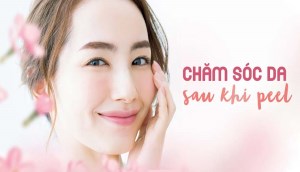 Mách bạn cách chăm sóc da sau khi peel để da phục hồi nhanh chóng nhất