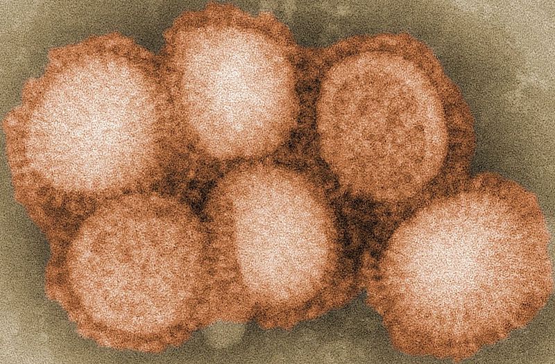 Chủng virus G4 EA H1N1