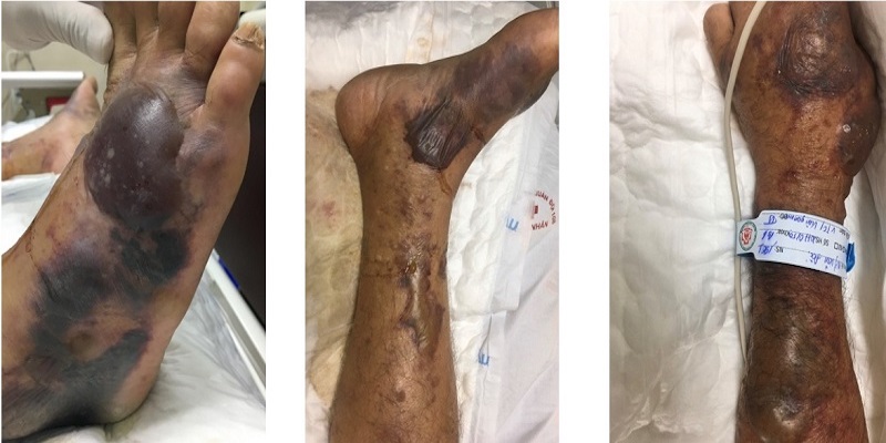 Hình ảnh da của bệnh nhân khi nhập viện
