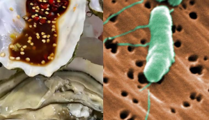 Bác sĩ cảnh báo vi khuẩn ăn thịt người trong các loại hải sản chín tái!