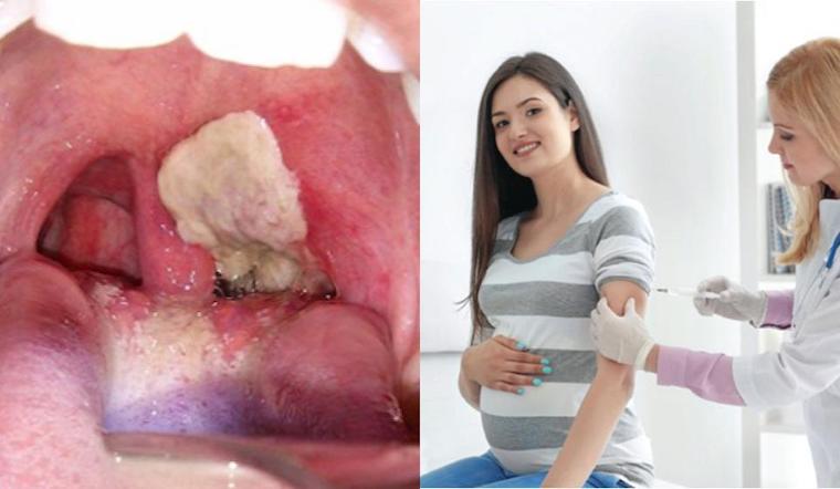 Phụ nữ mang thai có được tiêm phòng vắc-xin phòng bệnh bạch hầu không?
