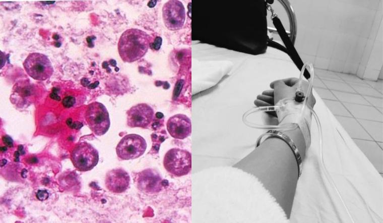 Covid-19 chưa qua, Mỹ lại phải đối mặt với loại trùng ăn não nguy hiểm với tỷ lệ tử vong đến 97%