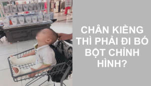 Bác sĩ Nhi khoa nói gì về thông tin trẻ biết đi sớm bị chân vòng kiềng