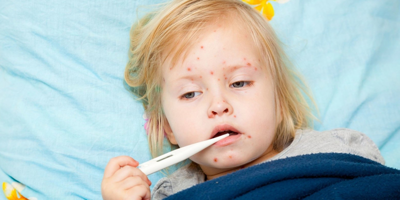 Cách chăm sóc trẻ bị sốt xuất huyết tại nhà