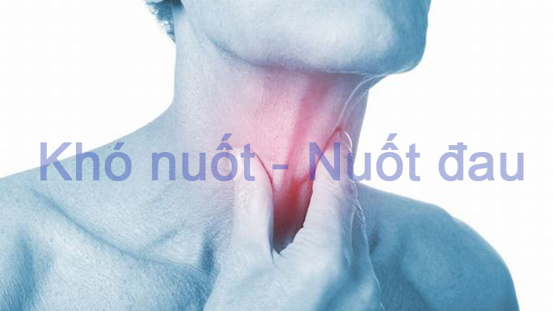 Khó nuốt và nuốt nghẹn