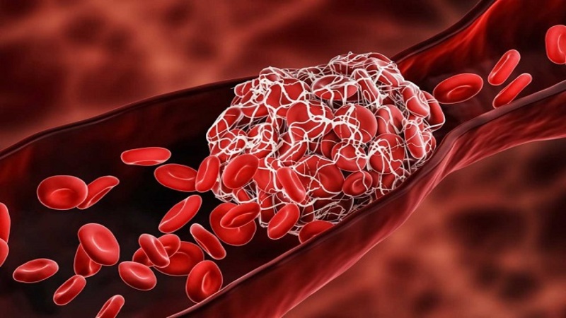 Omega 3 giúp ngăn ngừa sự hình thành các cục máu đông