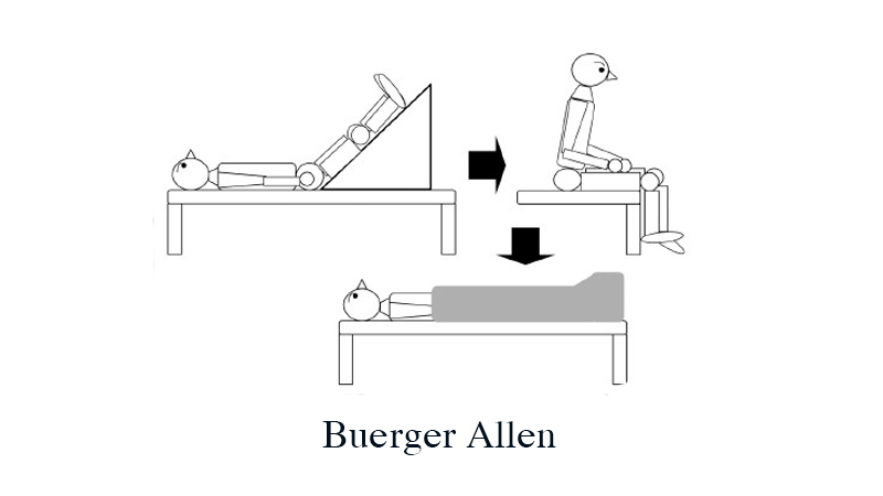 Bài tập Buerger Allen hỗ trợ giảm suy giãn tĩnh mạch