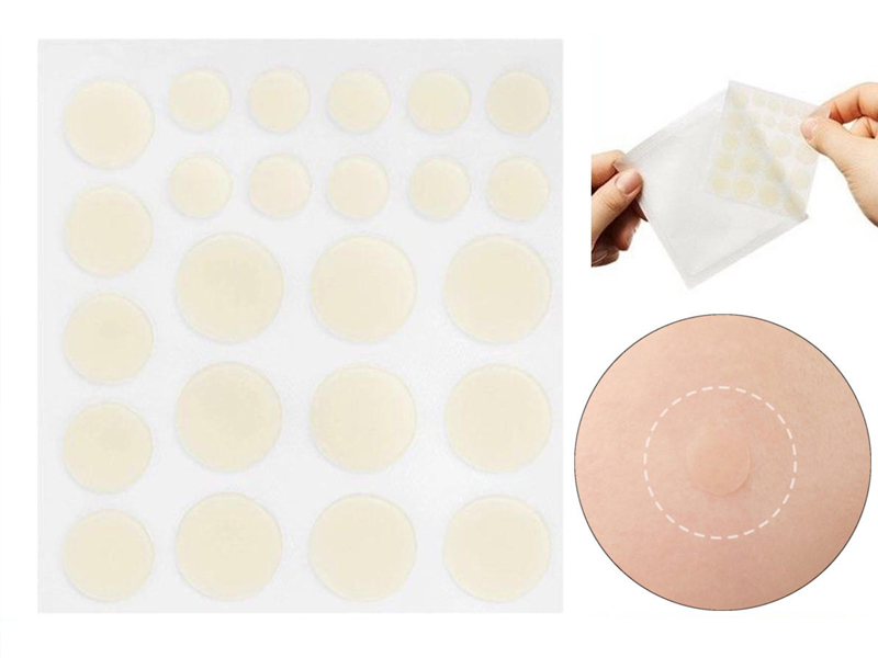 What is an acne patch? Is it okay to use acne patches regularly?