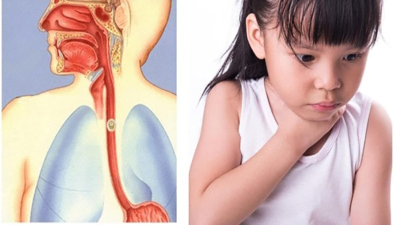 Không chỉ giàu collagen, món ăn vặt này còn có nhiều công dụng lợi hại hơn nhiều