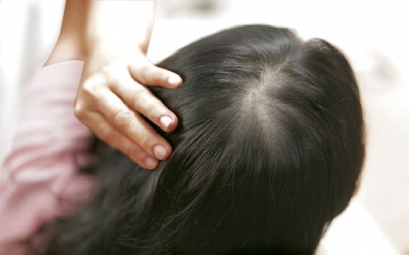 Cách tẩy tế bào chết cho da đầu giúp tóc đỡ bết dính, suôn mượt hơn